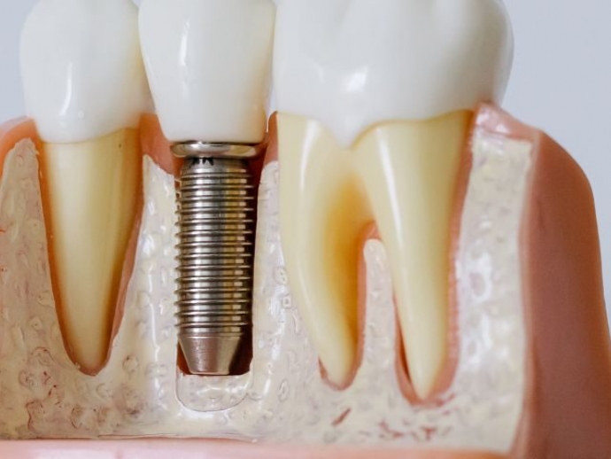 Map Dentist: The Future of Dental Care with Remote Consultations